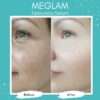 Hyaluronic Acid Serum - For Smooth and Radiant Skin - Image 5